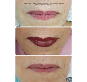 Healed Mature Lip Soft Shape Restoration Gallery Photos: Microblading, Semi Permanent Makeup & Medical Tattoo