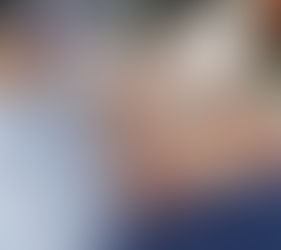 Scalp Micropigmentation SMP by El Truchan @ Scalp Micro Definition