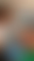 SMP Hair tattoo Scalp Micropigmentation by El Truchan @ Scalp Micro Definition