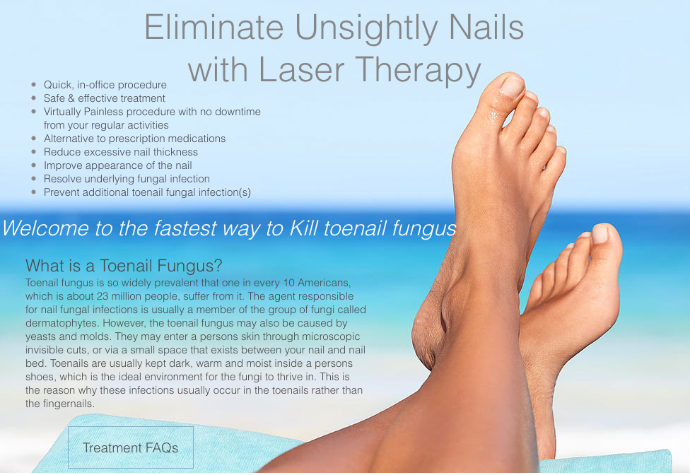 Treat Toenail Fungus with Laser Therapy Treatments