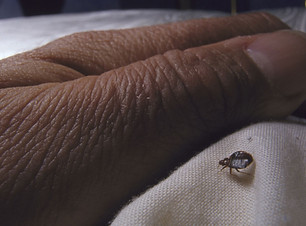 bed bug hands.jpg