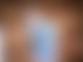Andrea with a light blue shirt and an eye patch under her glasses.