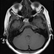 Arrested Pneumatization of the Sphenoid Sinus – A Professional Teaching Case_CaseNo: HN.2.2.3.001 