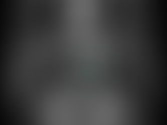 TÜRKÇE VAKA TARTIŞMA-1