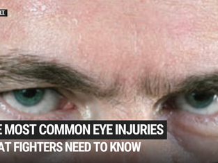 How Serious Are Eye Injuries in Martial Arts? What Fighters Need to Know!