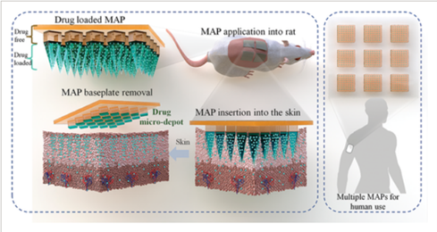 Drug loaded microarray patch.