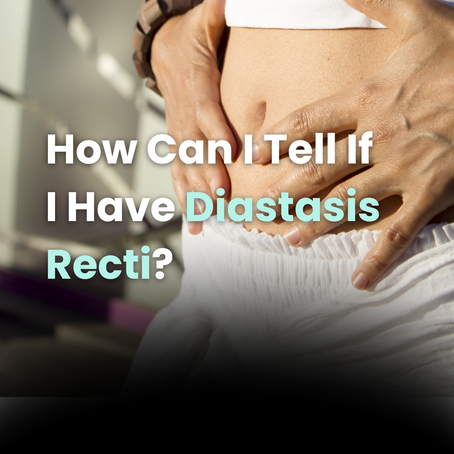 How Can I Tell If I Have Diastasis Recti?