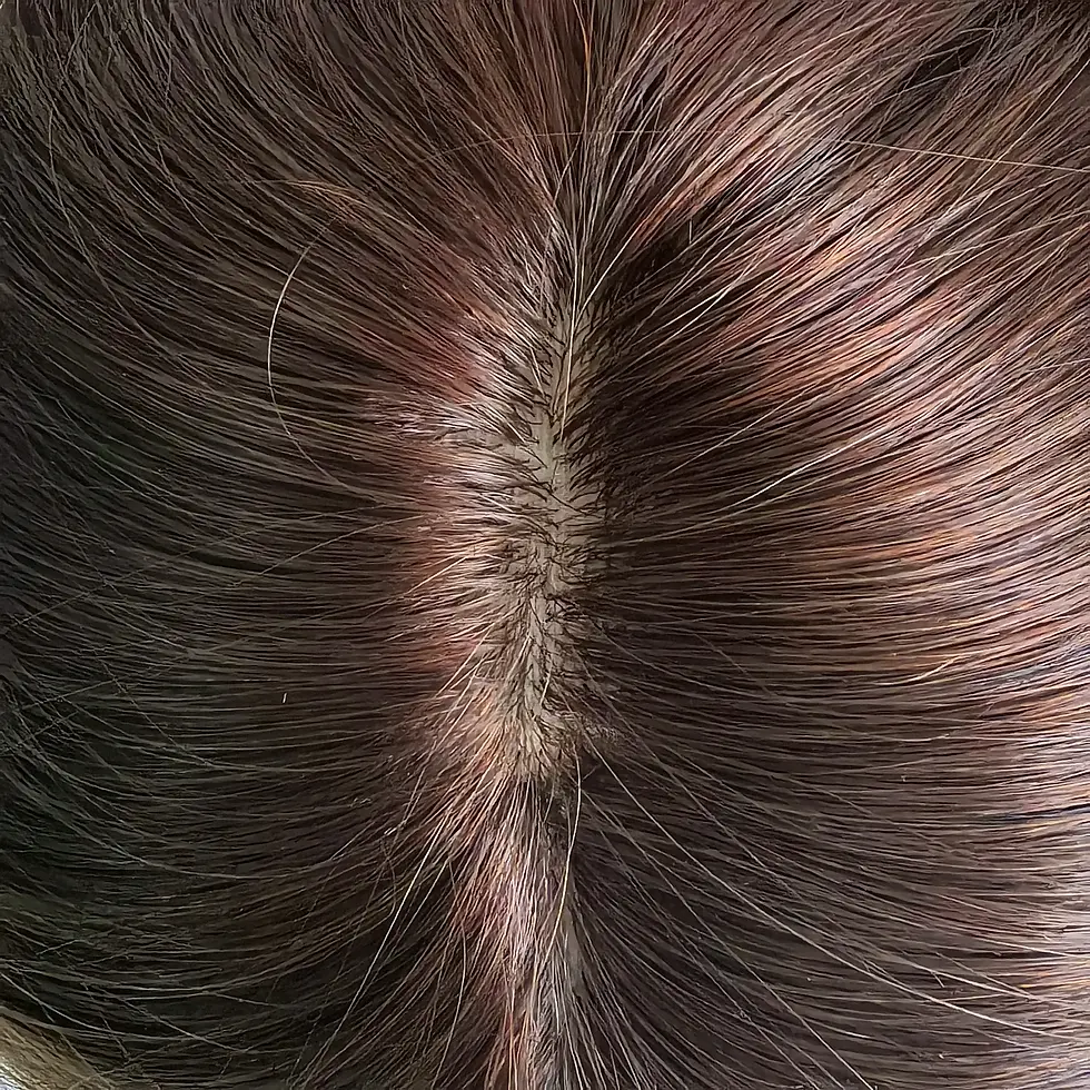 Thumbnail: Close-up of natural-looking hairpiece top