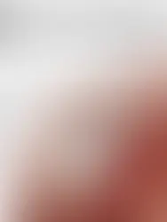 A Clinical Perspective on Shoulder Repair: My Interview with Dr. Ponnanna KM in Bangalore