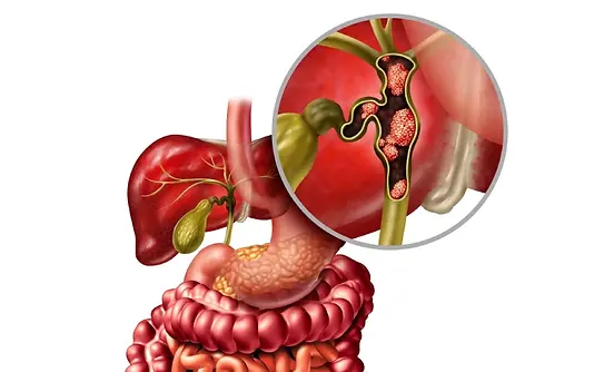 gall bladder cancer treatment