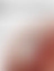 Inside the OT: Reporting on Arthroscopic Rotator Cuff Repair in Bangalore