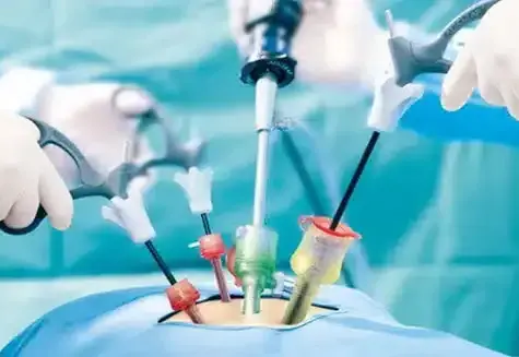 Laparoscopic and Minimally Invasive Surgery in Thane: Advanced Women’s Care by Dr. Arohi Tasgaonkar