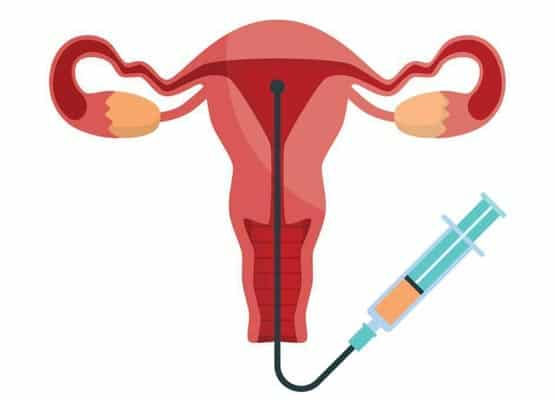 Infertility Specialist in Thane