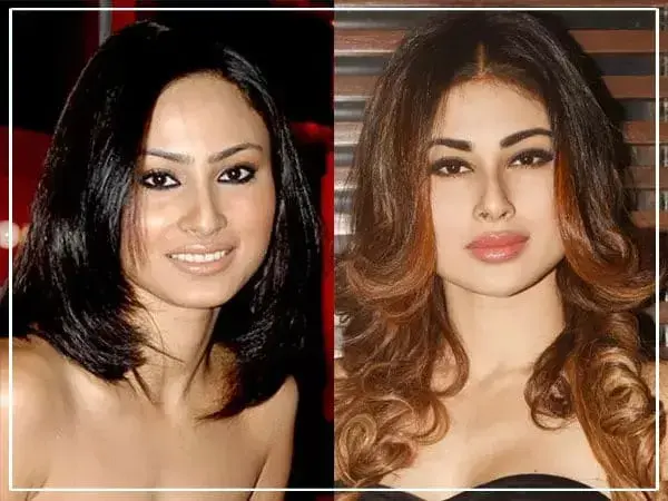 Lip Augmentation Filler: Enhance Your Smile with Natural-Looking Results