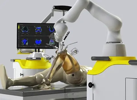 Robotic Knee Replacement Surgery with Dr Ponnanna KM | Bangalore Insights