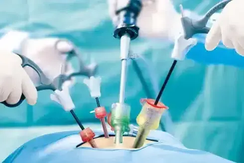 Laparoscopic and Minimally Invasive Surgery in Thane