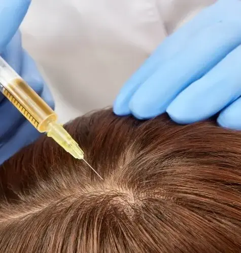 My Visit to a Leading Dermatologist for PRP Hair Treatment in Mumbai