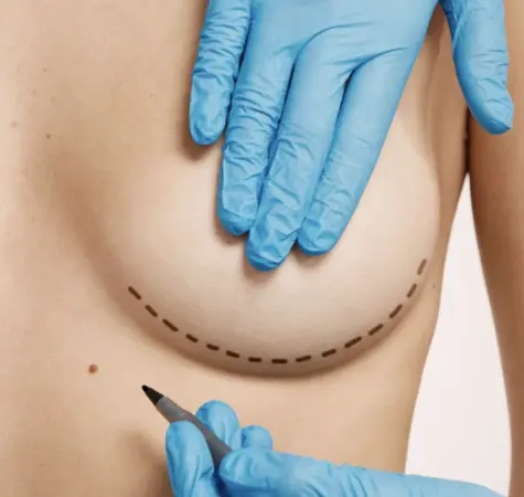 Breast Reduction Surgery in Mumbai: Expert Care by Dr. Devayani Barve at Jewel Aesthetic Centre