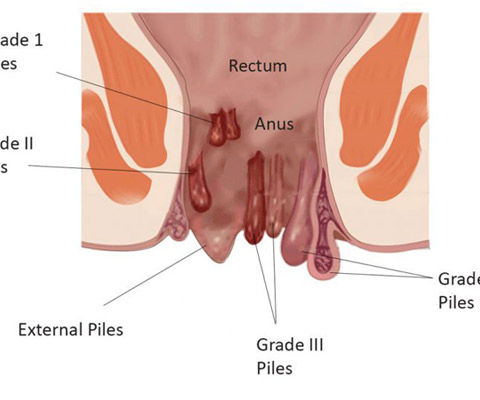 A Medical Journalist’s Interview with Dr. Vedant Karvir at Globus Hospital, Mumbai