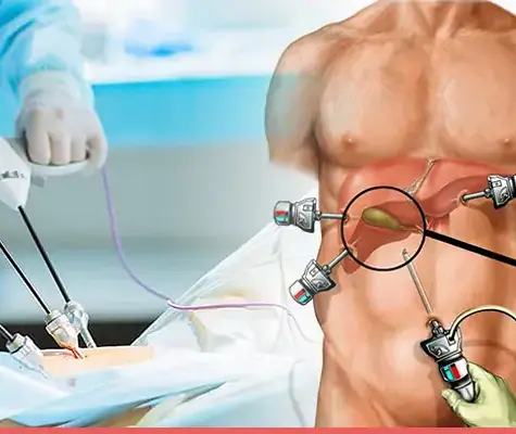 A Journalist’s Conversation With Dr. Chintamani Godbole About Gall Bladder Surgery in Mumbai