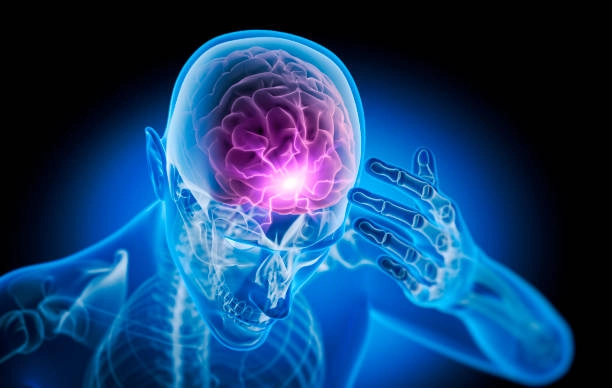Advance Epilepsy Treatment in South Mumbai