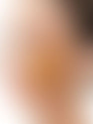 Understanding Facial Contouring in Mumbai