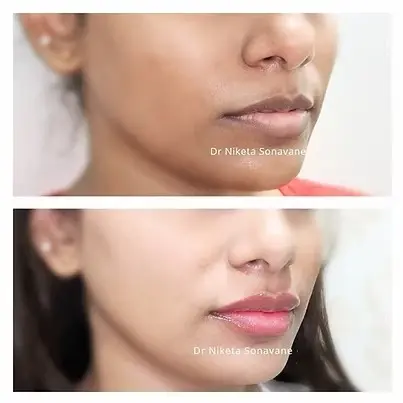 skin whitening treatment in mumbai