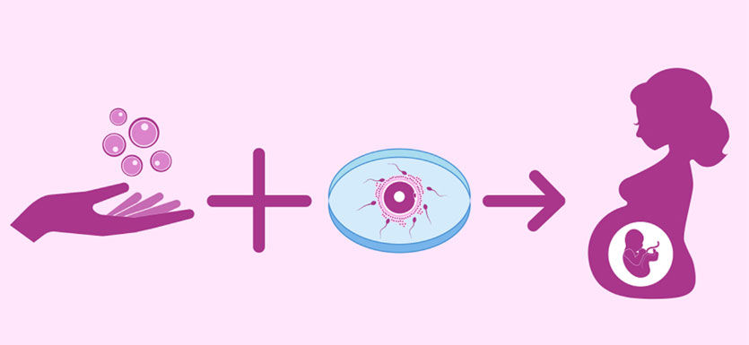 Donor Egg IVF Cost in Mumbai