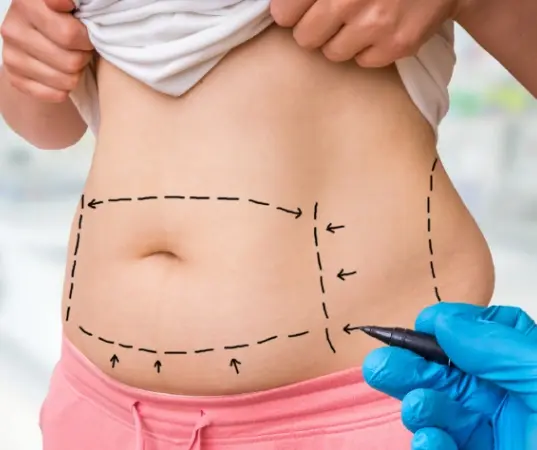A First-Hand Look at Liposuction Surgery in Mumbai