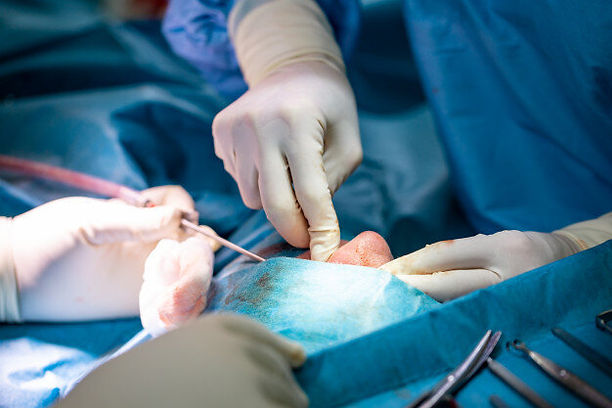 Rhinoplasty Surgery Cost Mumbai