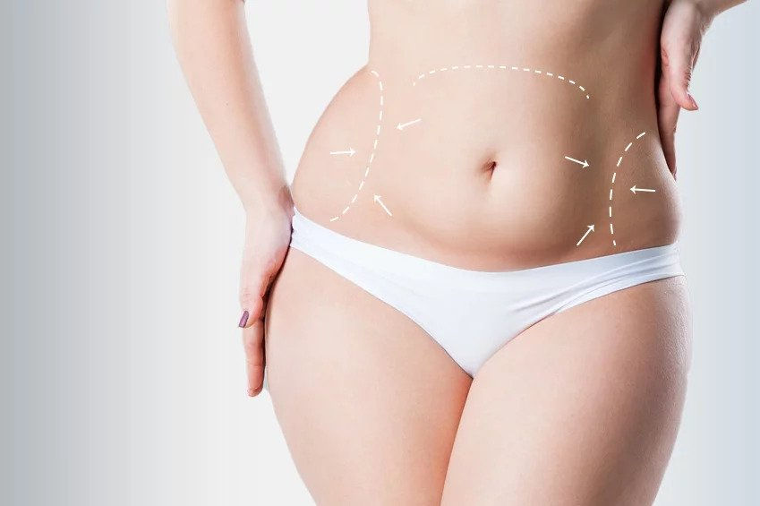 Tummy Tuck Mumbai