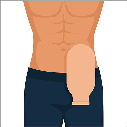 Rectal Cancer Treatment