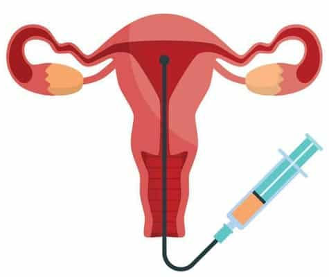 Understanding Infertility: An Exclusive Interview with Dr. Arohi Tasgaonkar, Leading Infertility Specialist in Thane