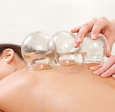 Cupping Therapy (5).jpg