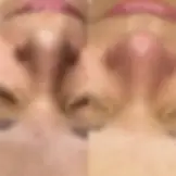 deep-cleansing-facial-before-after.webp