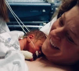 Temoignage De Fanny Sur La Preeclampsie