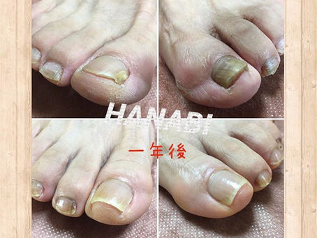 Before→After　写真