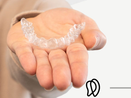 Mais que estética: o impacto do desalinhamento dentário na saúde geral