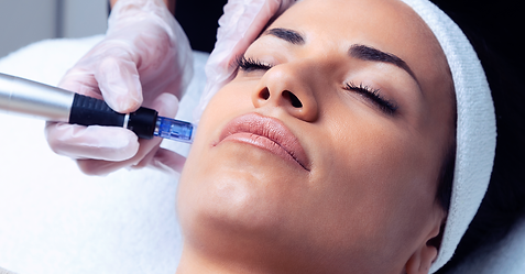 Microneedling-2.png
