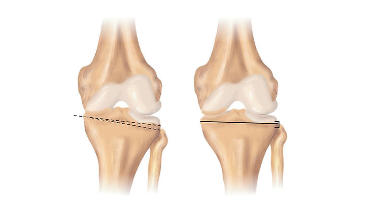 site-Dr. Lucas Damico - Osteotomia no Jo