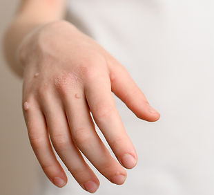 yipsi_skin_care_Ombre_Wat Removal.jpg