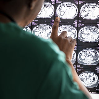 doctor-reading-brain-mri-x-ray-result (1).jpg