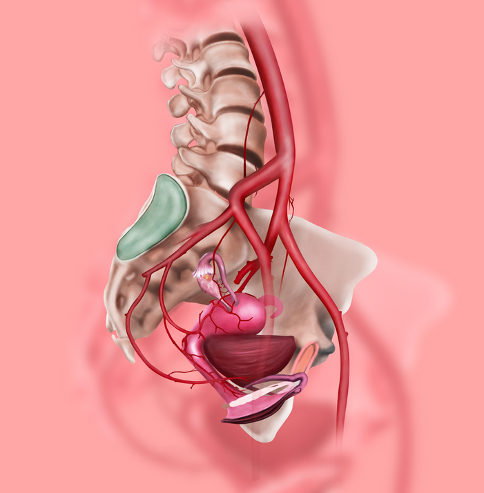 uterine_arteries.png