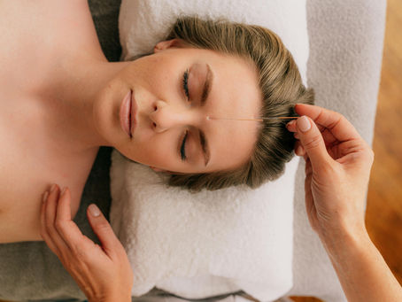 Discover the Top 10 Benefits of Cosmetic Acupuncture
