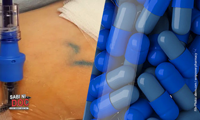 Sabi ni Doc - Methylene blue