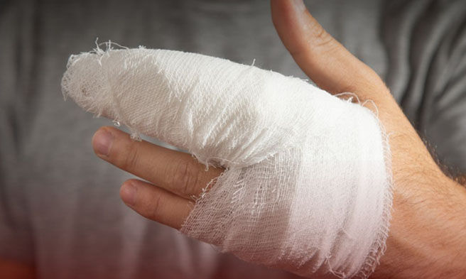 Biktima ng paputok 2