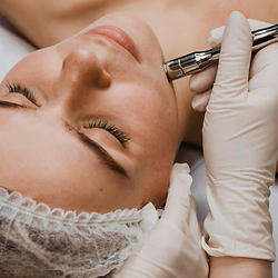 Limpieza profunda con punta de diamante. Elimina las impurezas, trata acné con peeling químico. BrisArt Estética Avanzada, en calle Enguera 37, valencia