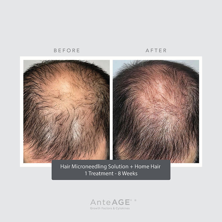 AnteAGE MD Hair B+A Feed Post.jpg