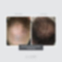 anteage-md-hair-ba-social-asset-7.jpg