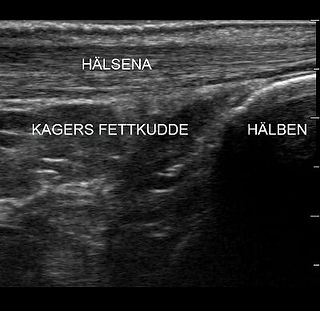 sjukgymnastik-ultraljudsdiagnostik-halsena.jpg